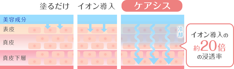 ケアシスはイオン導入の20倍の浸透率
