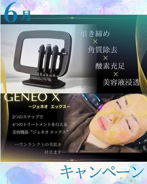 ジェネオエックス